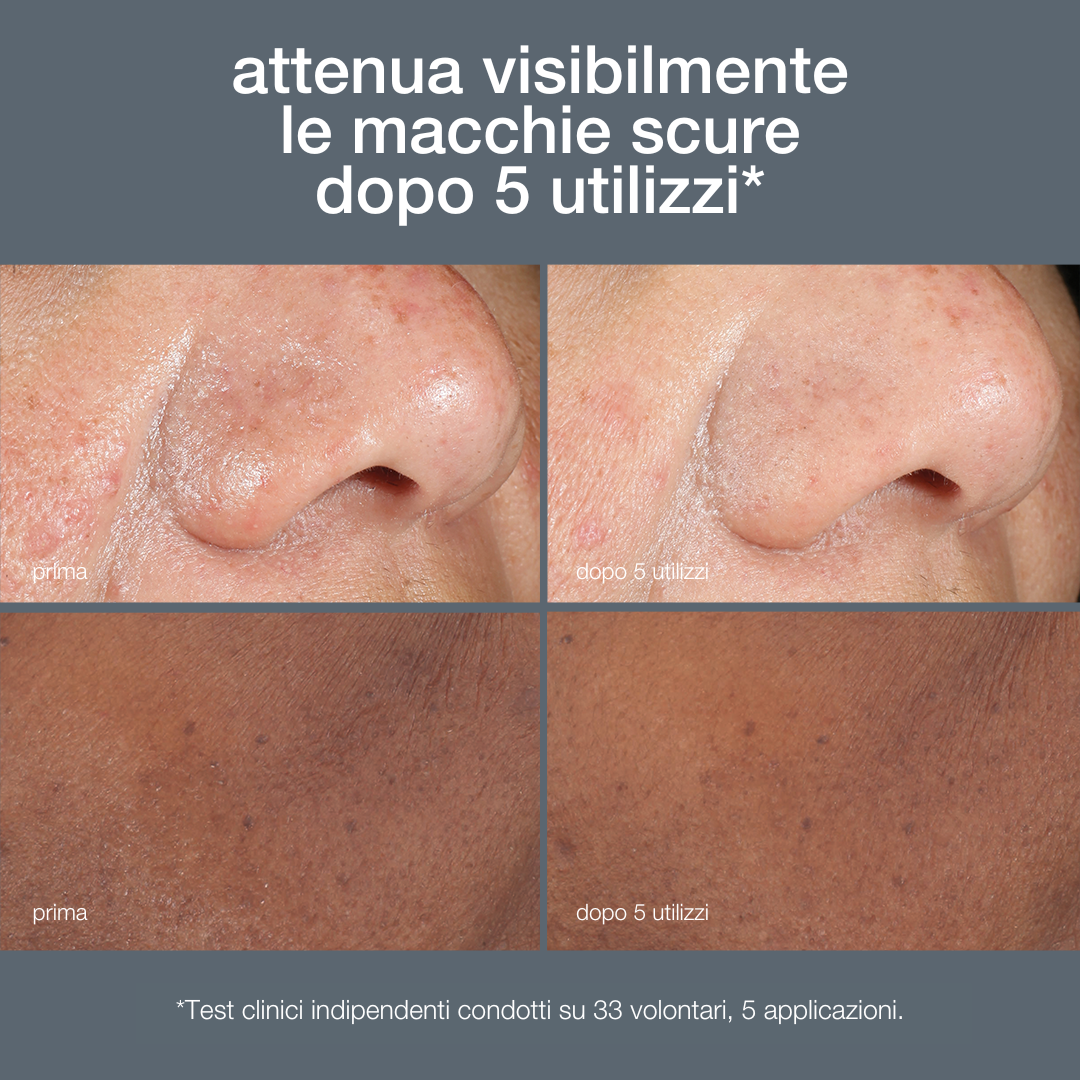 PowerBright Dark Spot Peel | Attenua visibilmente l'iperpigmentazione