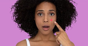Che tipo di acne ho? | Dermalogica Italia